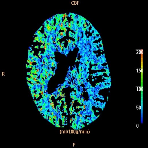 Neuroradiology | OHSU